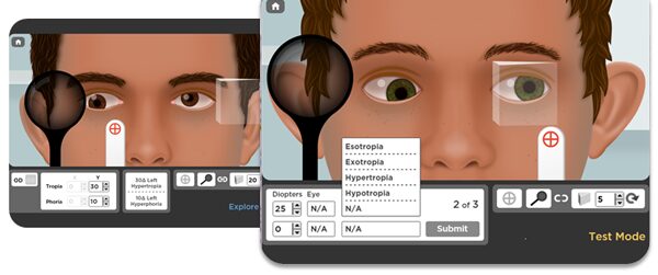 Strabismus simulator